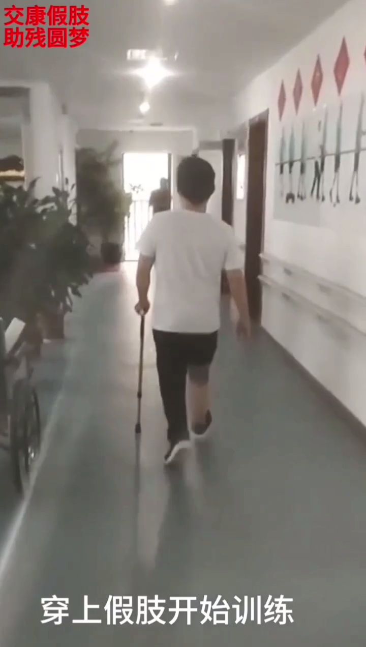 Rehabilitation training for calf prosthesis scene