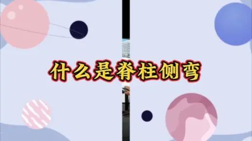 脊柱侧弯的知识普及