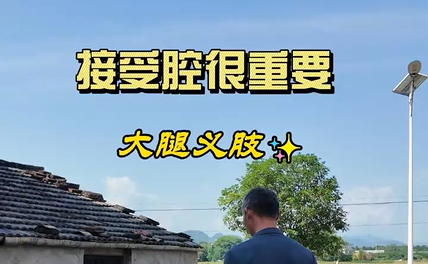 仙居的大哥安装大腿假肢