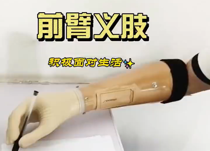 前臂肌电假肢展示写字