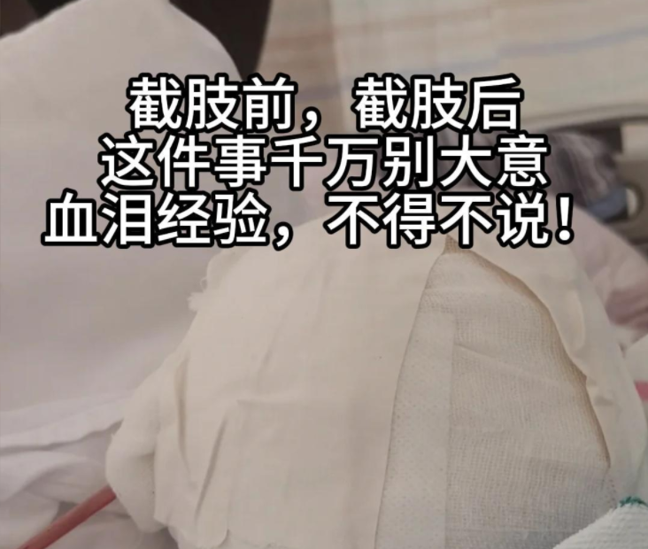 截肢前后，这3件事别大意！血泪经验必看