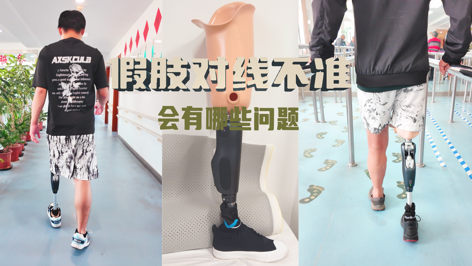 假肢对线不准，会有哪些问题