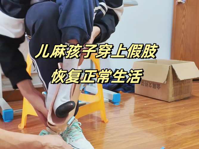 儿麻孩子穿上了假肢恢复正常生活