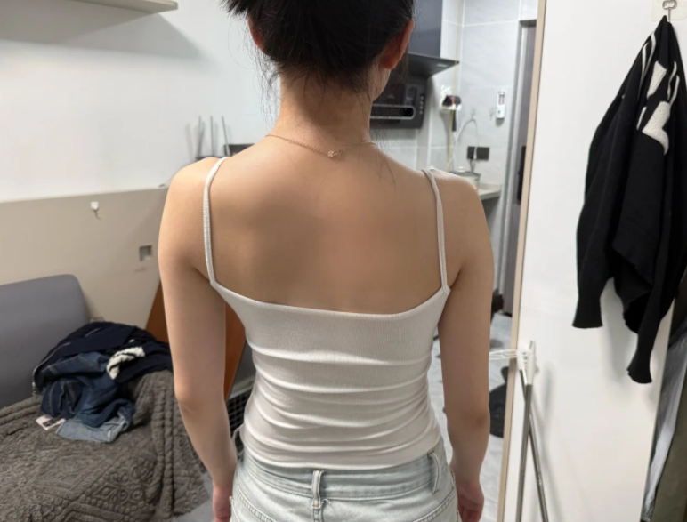 脊柱侧弯矫正：多久能看到改善？专业康复师答疑