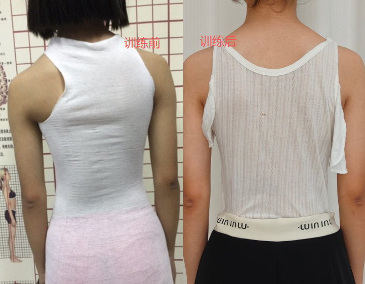 脊柱 “正” 当时：这个六一，为孩子的健康脊梁 “保驾护航”